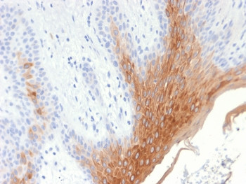 Anti-KRT10 / Cytokeratin 10, clone KRT10/1990R