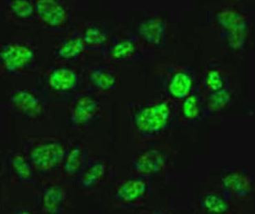 Anti-phospho-p53 (Ser9)