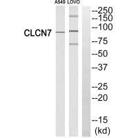 Anti-CLCN7