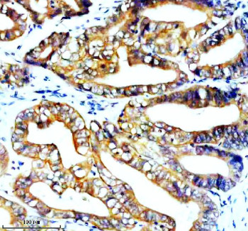 Anti-STK33 / Serine/threonine-protein kinase 33