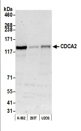 Anti-CDCA2