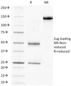 Anti-HCG-beta, clone HCGb/211