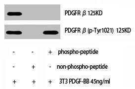 Anti-Phospho-PDGFRB (Y1021)