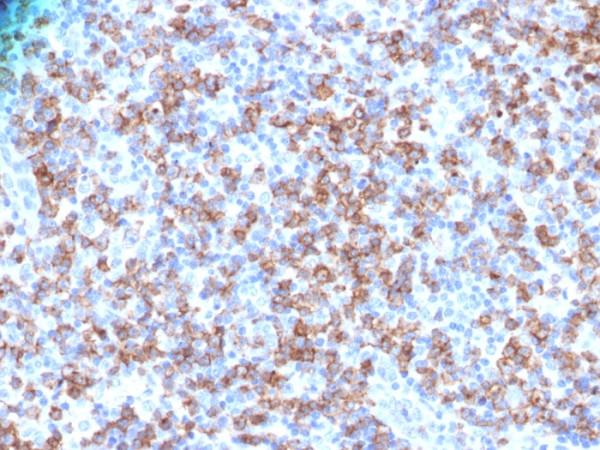 Anti-CD8A (Cytotoxic- &amp; Suppressor T-Cell Marker)