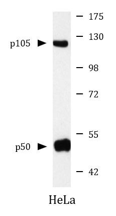 Anti-NFkB p105 / p50, clone 5E3-E4-C11