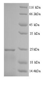 Interferon alpha-14 (IFNA14), human, recombinant
