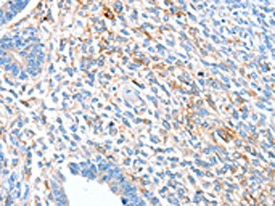 Anti-ALDH1A2