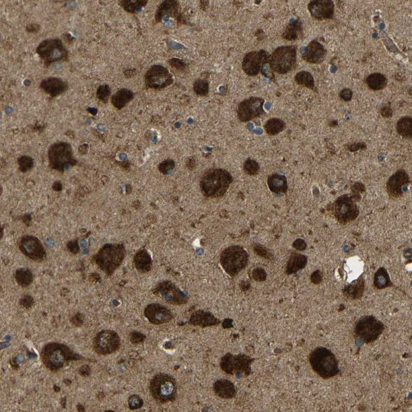 Anti-ATP7A