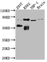 Anti-PRKCQ Recombinant Monoclonal, clone 1B2
