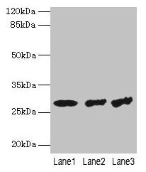 Anti-TBCB