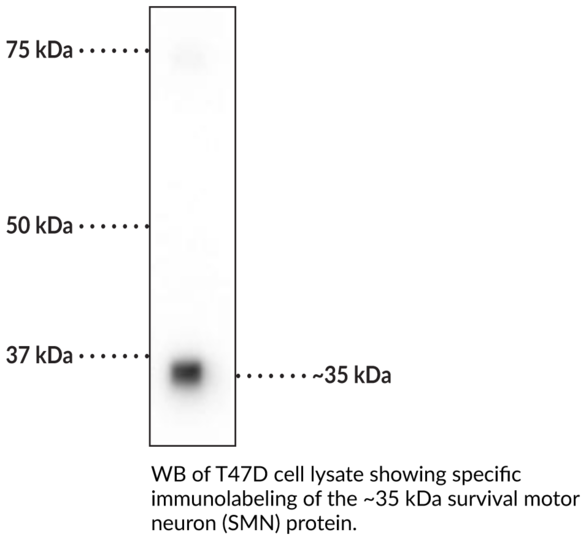 Anti-SMN Monoclonal Antibody (Clone 4B7)