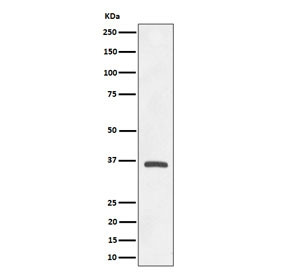 Anti-OXGR1 / 2-Oxoglutarate receptor 1 / GPR99, clone 29O18