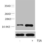 Anti-Acetyl-Histone H2A.Z (Lys7)