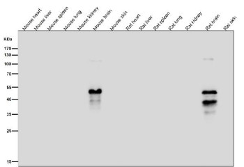Anti-phospho-MAP2 (Ser136) / Microtubule-associated protein 2, clone 32M37