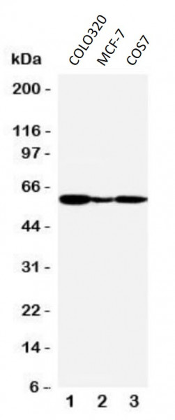 Anti-GPER1 / GPCR30