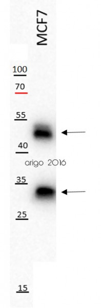 Anti-Cathepsin D