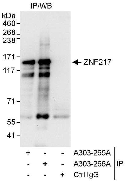 Anti-ZNF217