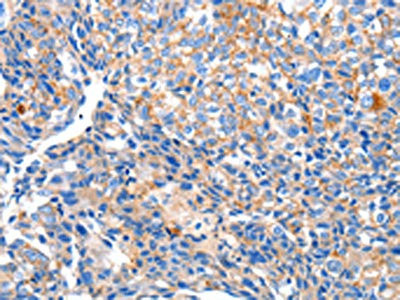 Anti-HCN2