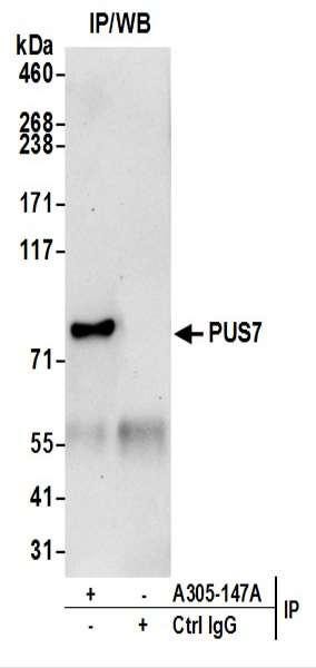 Anti-PUS7