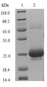 Sclerostin domain-containing protein 1 (Sostdc1), rat, recombinant