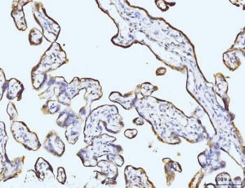 Anti-BZW2