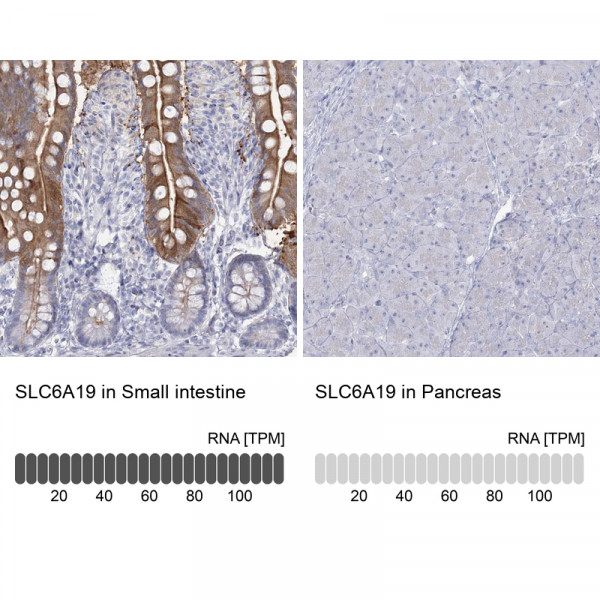 Anti-SLC6A19