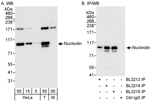 Anti-Nucleolin (NCL)