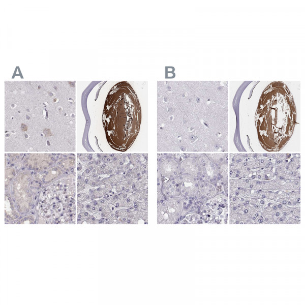 Anti-BFSP2