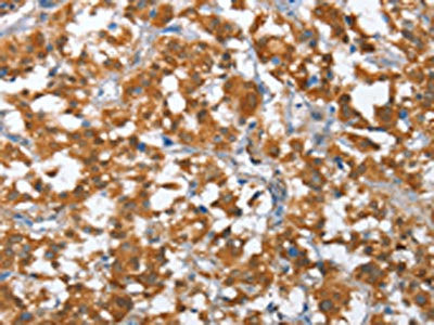 Anti-TP53BP2