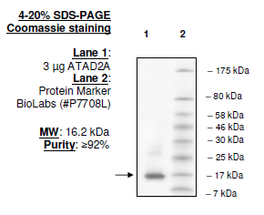 ATAD2A (981-1108), human, recombinant, N-terminal His tag