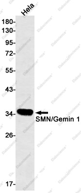 Anti-Recombinant Gemin 1, clone C122811