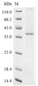 Zinc transporter ZIP6 isoform X1 (SLC39A6), partial, Macaca fascicularis, recombinant