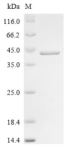 LIM and SH3 domain protein 1 (LASP1), human, recombinant