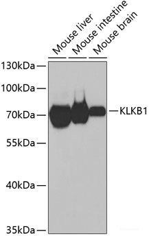 Anti-KLKB1 HC