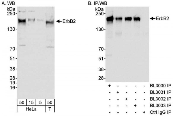 Anti-ErbB2