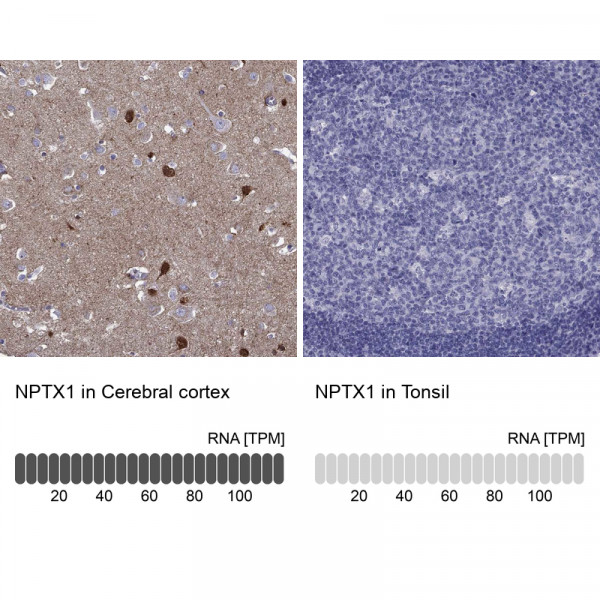 Anti-NPTX1