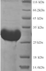 Thyroxine 5-deiodinase (Dio3), partial (170:U->missing), rat, recombinant