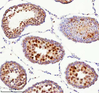 Anti-BCCIP / BRCA2 and CDKN1A-interacting protein