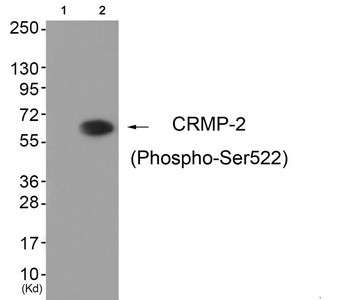 Anti-Phospho-DPYSL2 (Ser522)