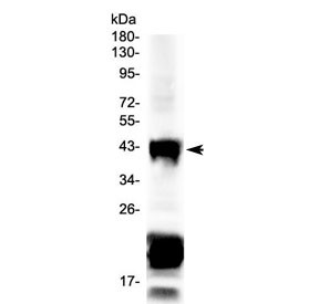 Anti-CHX10 / VSX2