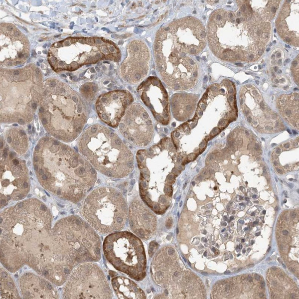 Anti-ZC3H12A