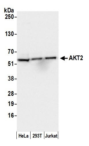 Anti-AKT2