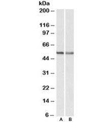 Anti-CB1