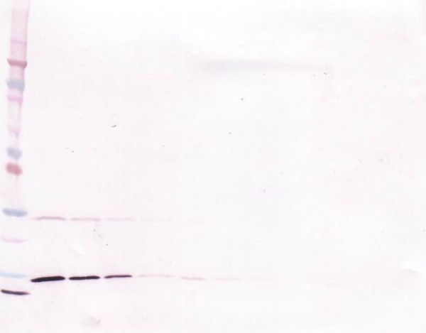 Anti-IFN-gamma
