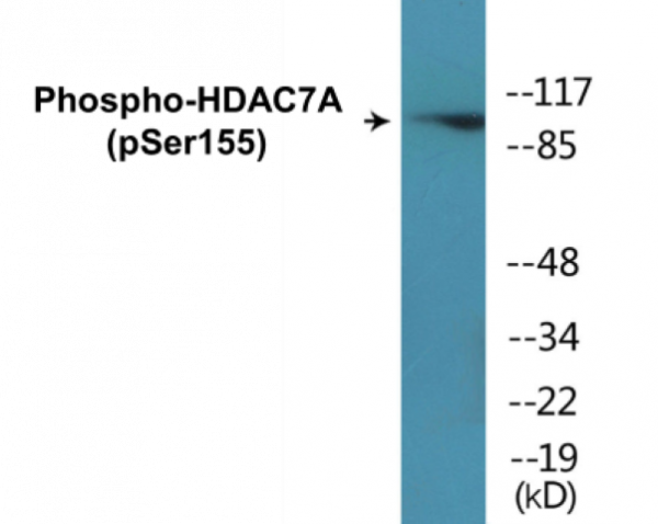 Phospho-HDAC7A (Ser155) In-Cell ELISA