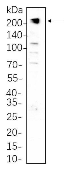 Anti-Recombinant PDGFR-beta, clone 4B12