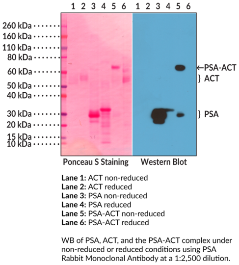 Anti-PSA Rabbit Monoclonal Antibody (Clone RM323)