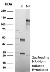 Anti-Fas / Fas cell surface death receptor, clone rGM30