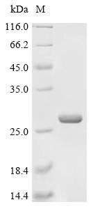 Dehydrogenase/reductase SDR family member 4-like 2 (DHRS4L2), recombinant human