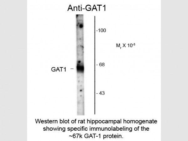 Anti-GABA Transporter 1 (GAT1)